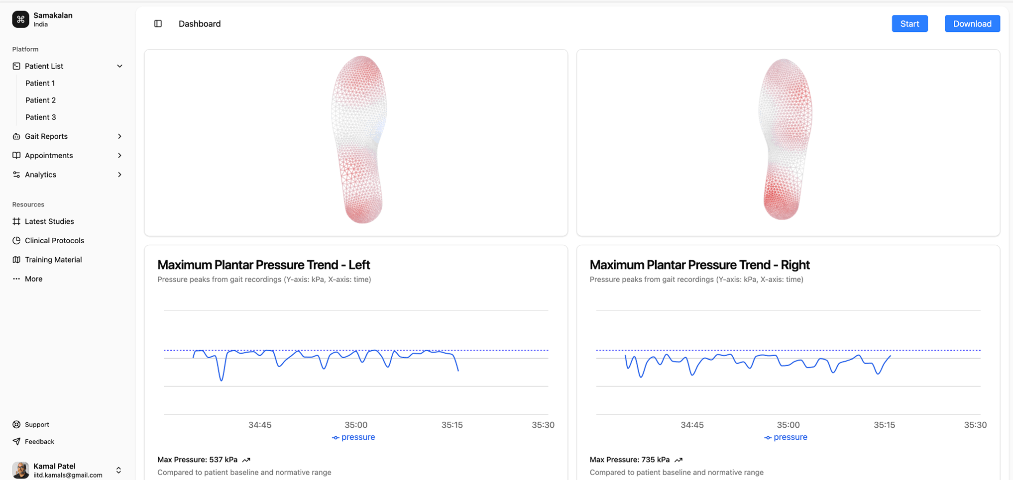 Solemate is a web and mobile app that connects to smart insoles developed by Samakalan Labs to track foot activity in real time. From 3D pressure mapping to gait analysis, it delivers clear, actionable insights through an intuitive dashboard - designed by eigenstudio.